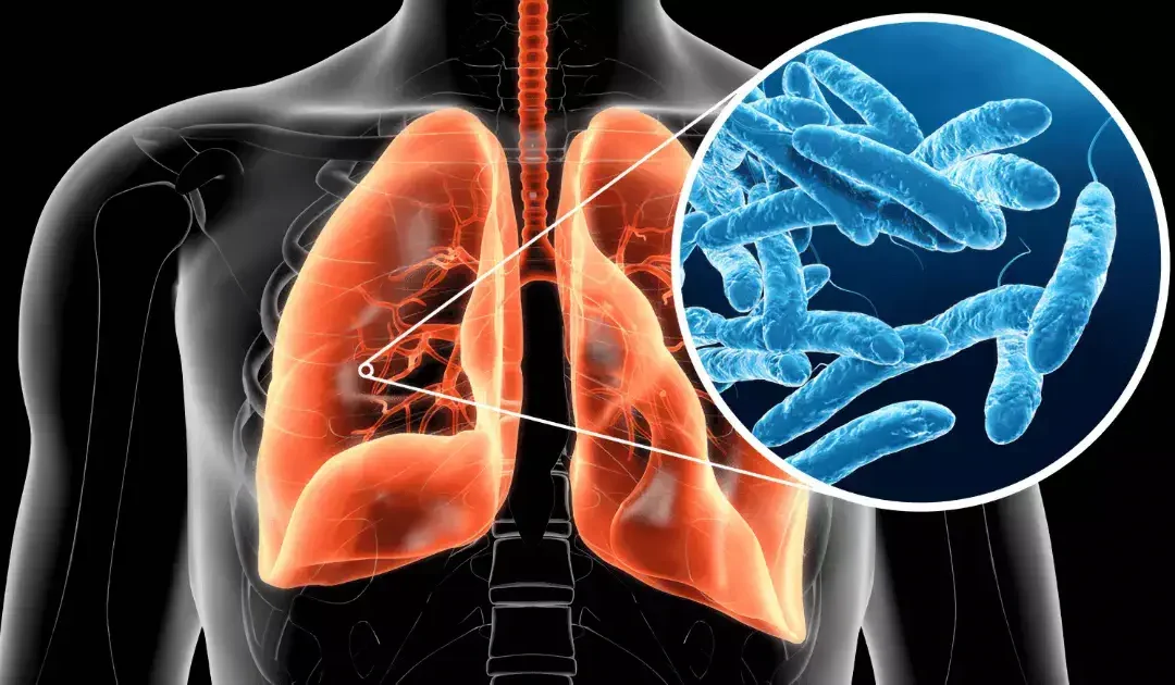 Bonifica di un riunito odontoiatrico mediante applicazione di un sistema di disinfezione a osmosi inversa e biossido di cloro