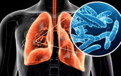 Bonifica di un riunito odontoiatrico mediante applicazione di un sistema di disinfezione a osmosi inversa e biossido di cloro